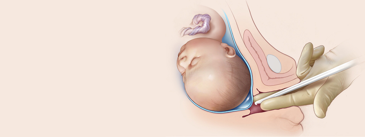 Labor Induction 101: What It Means, When It’s Needed, And What To Expect